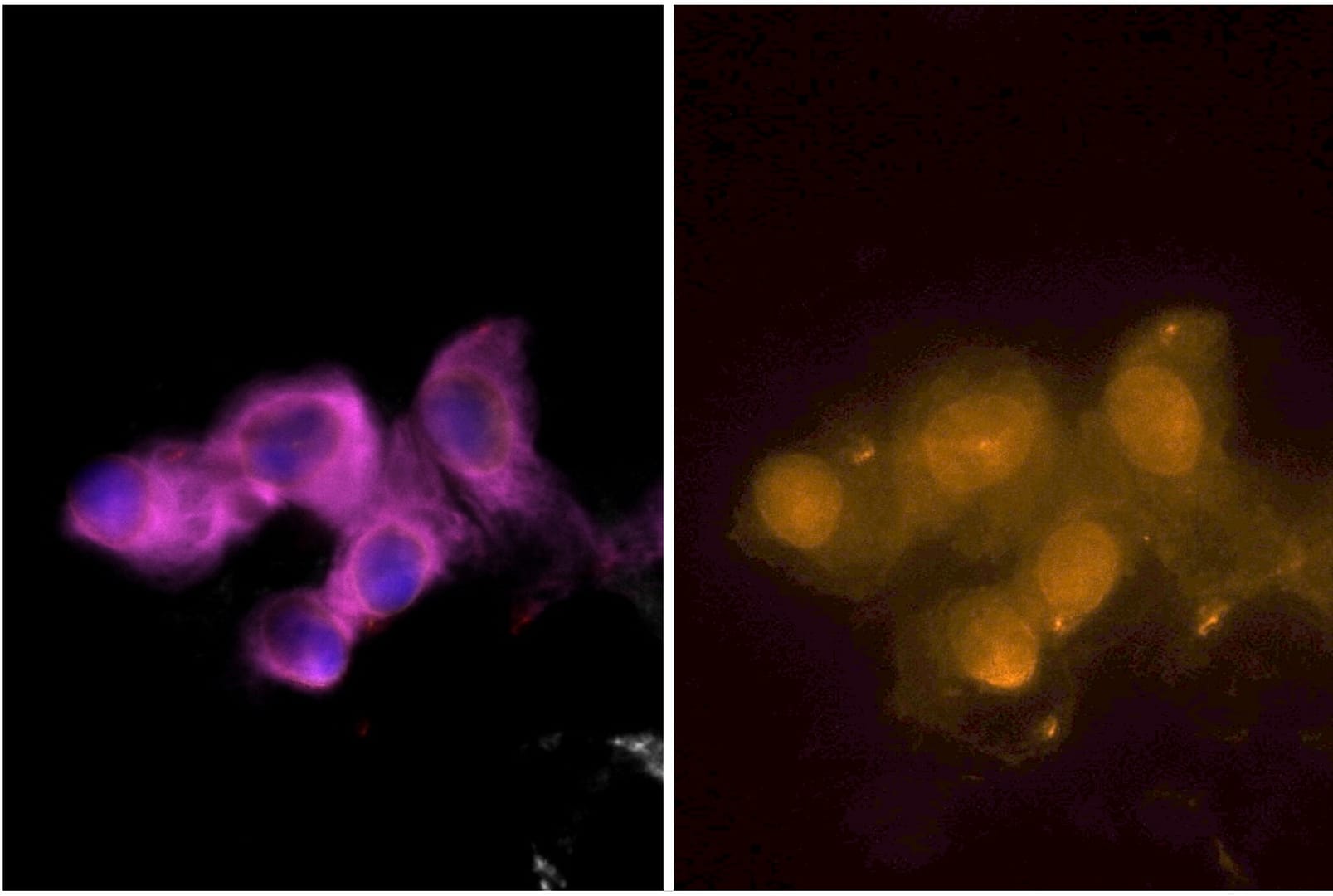 DNA damage response (DDR) assays for non-invasive treatment response monitoring