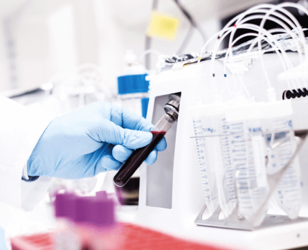 Blood processing in a lab