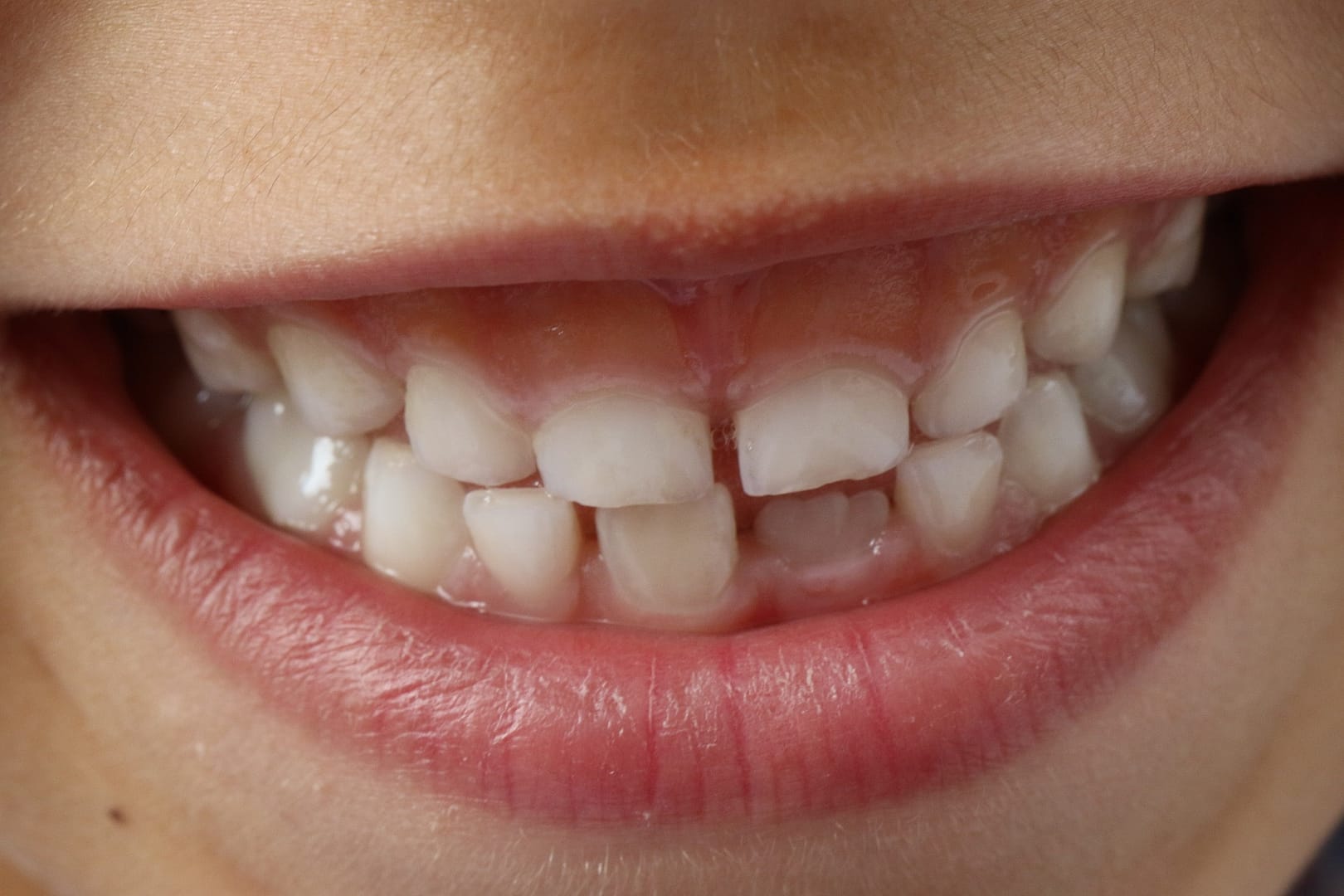 Lesson 2: Human teeth