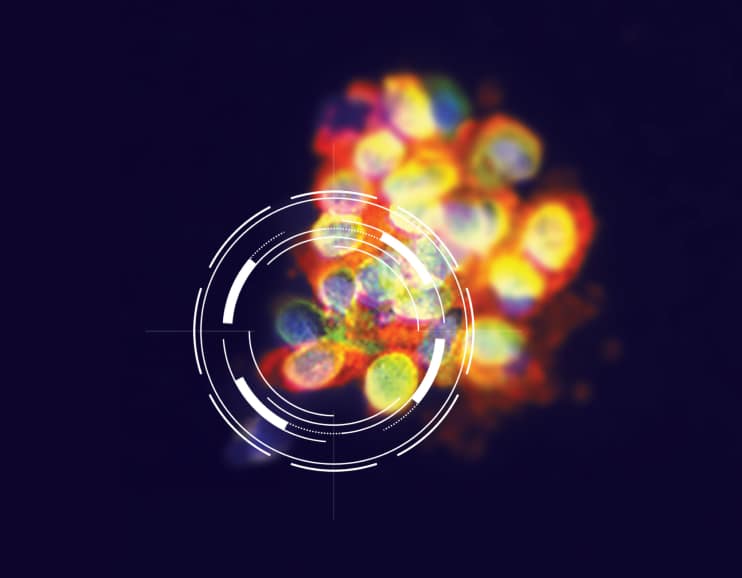 Portrait®PD-L1 - Optimize your cancer therapy trials